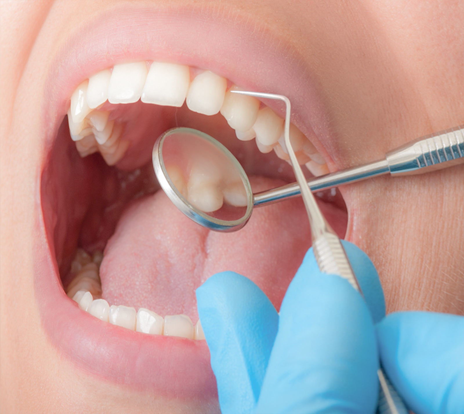 Удаление москва. Терапевтическая стоматология. Зубы стоматолог. Терапия стоматология.